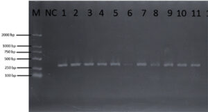 PCR results Babaesia spp. on pangolin