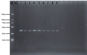 PCR Anaplasma spp. on pangolin results