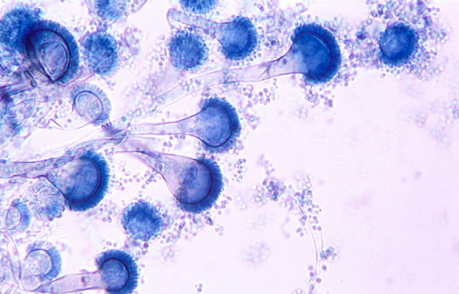 vi nấm aspergillus-fumigatus