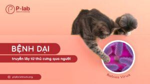 Bệnh dại truyền lây từ thú cưng qua người như thế nào?